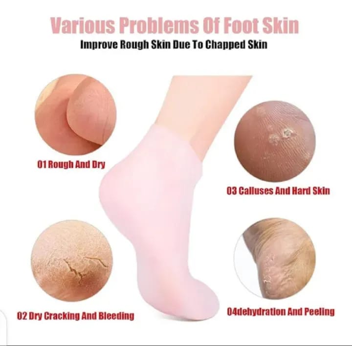 Silicone Heel Socks - Moisturizing Gel Socks - Cracked Heel Repair - Reusable Heel Protector (Pair)